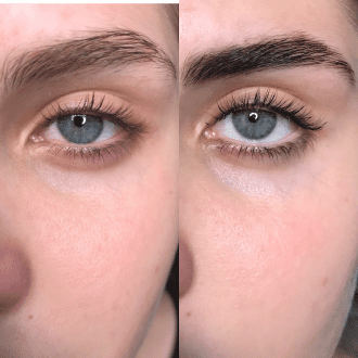 Фото альбома